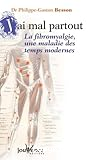 J'ai mal partout. La fibromyalgie